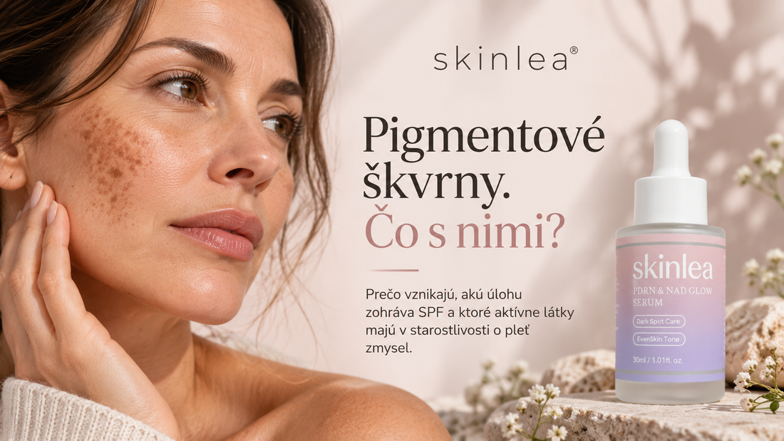 Pigmentové škvrny na tvári: prečo vznikajú a čo s nimi môžete reálne robiť?